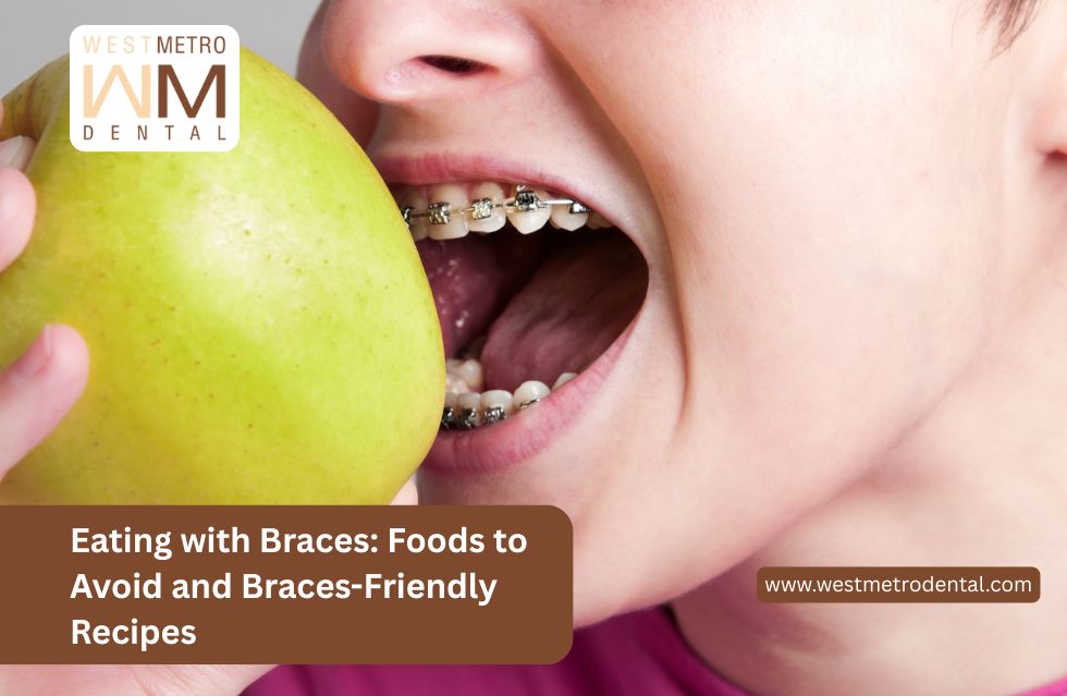Eating with Braces: Foods to Avoid and Braces-Friendly Recipes